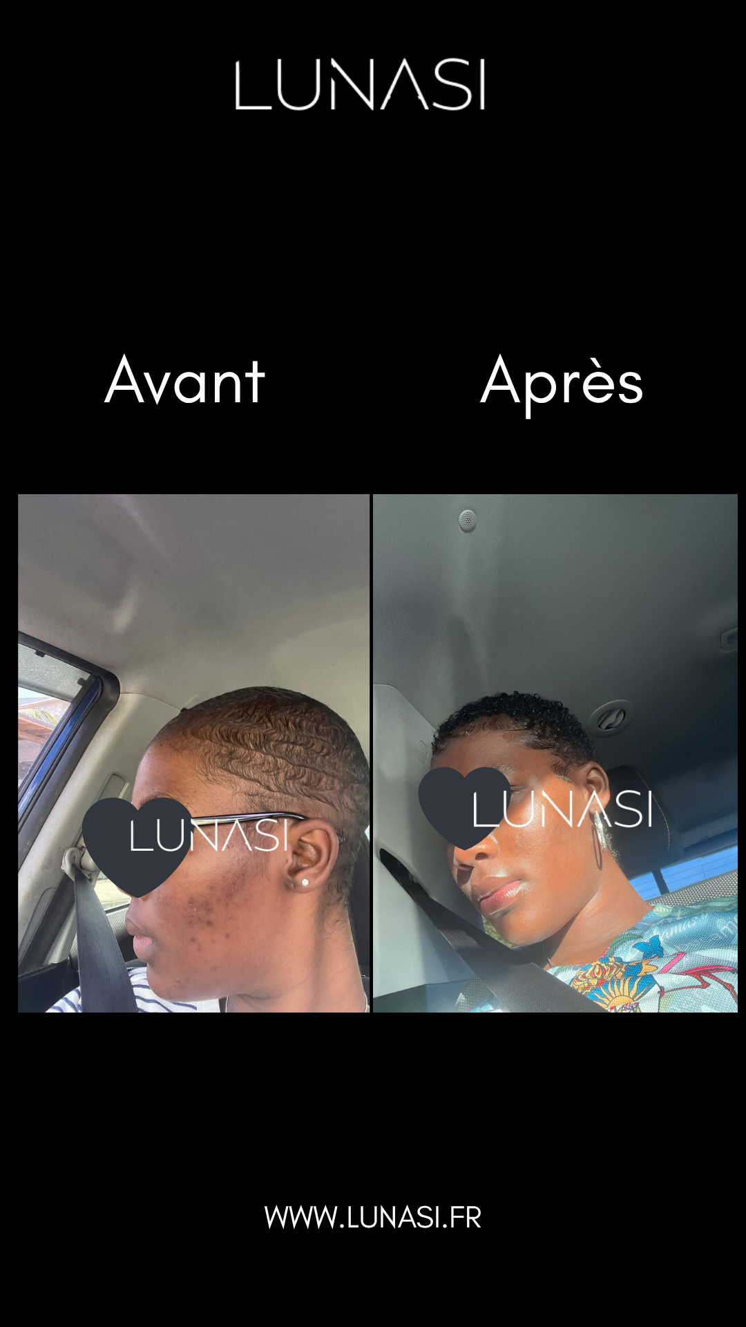 PERFECT SKIN TREATMENT - TRIO TRAITEMENT 30 jours.