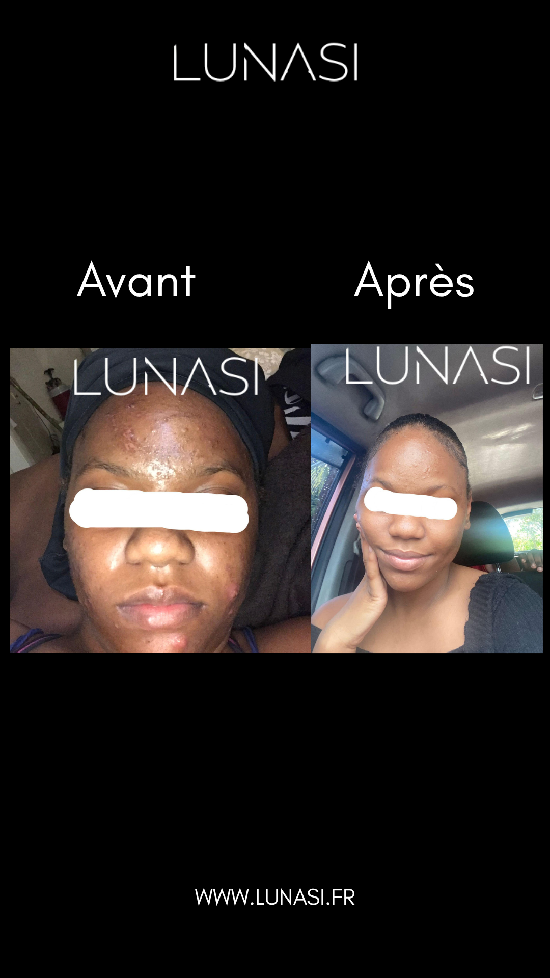 PERFECT SKIN TREATMENT - TRIO TRAITEMENT 30 jours.