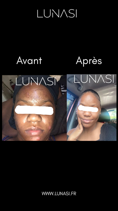 PERFECT SKIN TREATMENT - TRIO TRAITEMENT 30 jours.